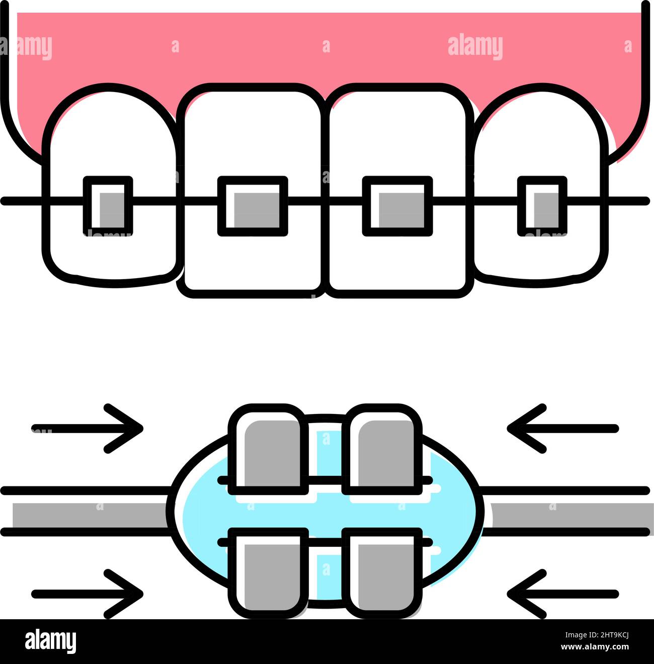 work process tooth braces color icon vector illustration Stock Vector ...