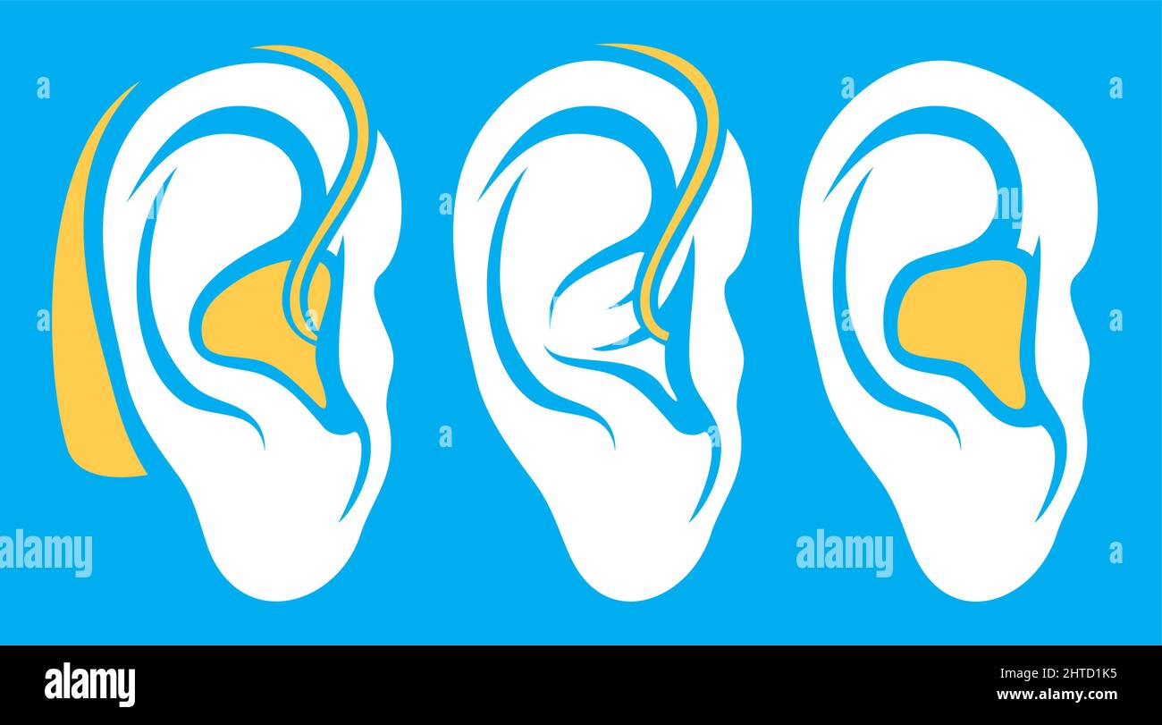 Ear hearing aid deaf problem icons collection vector illustration Stock ...