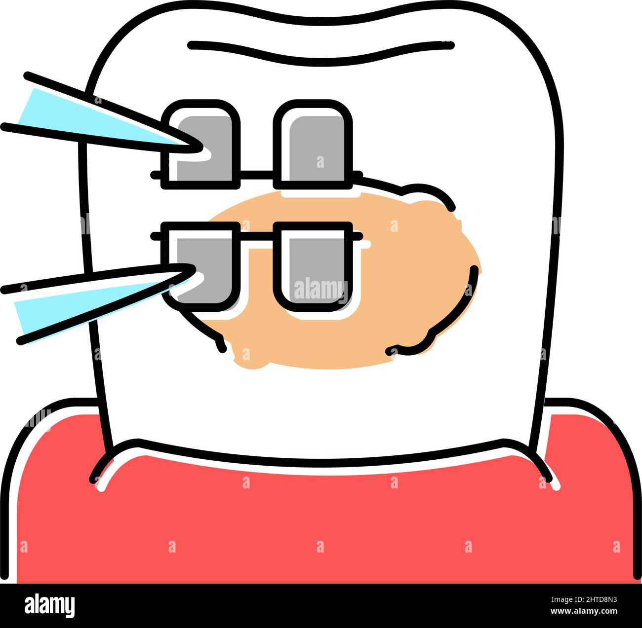 installation tooth braces color icon vector illustration Stock Vector ...