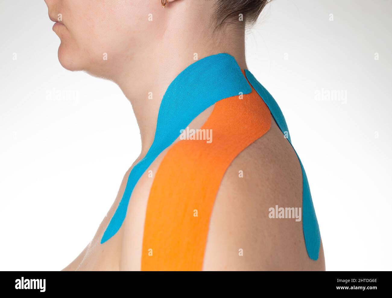 Fixation of muscles and ligaments on the girl's shoulder with blue and