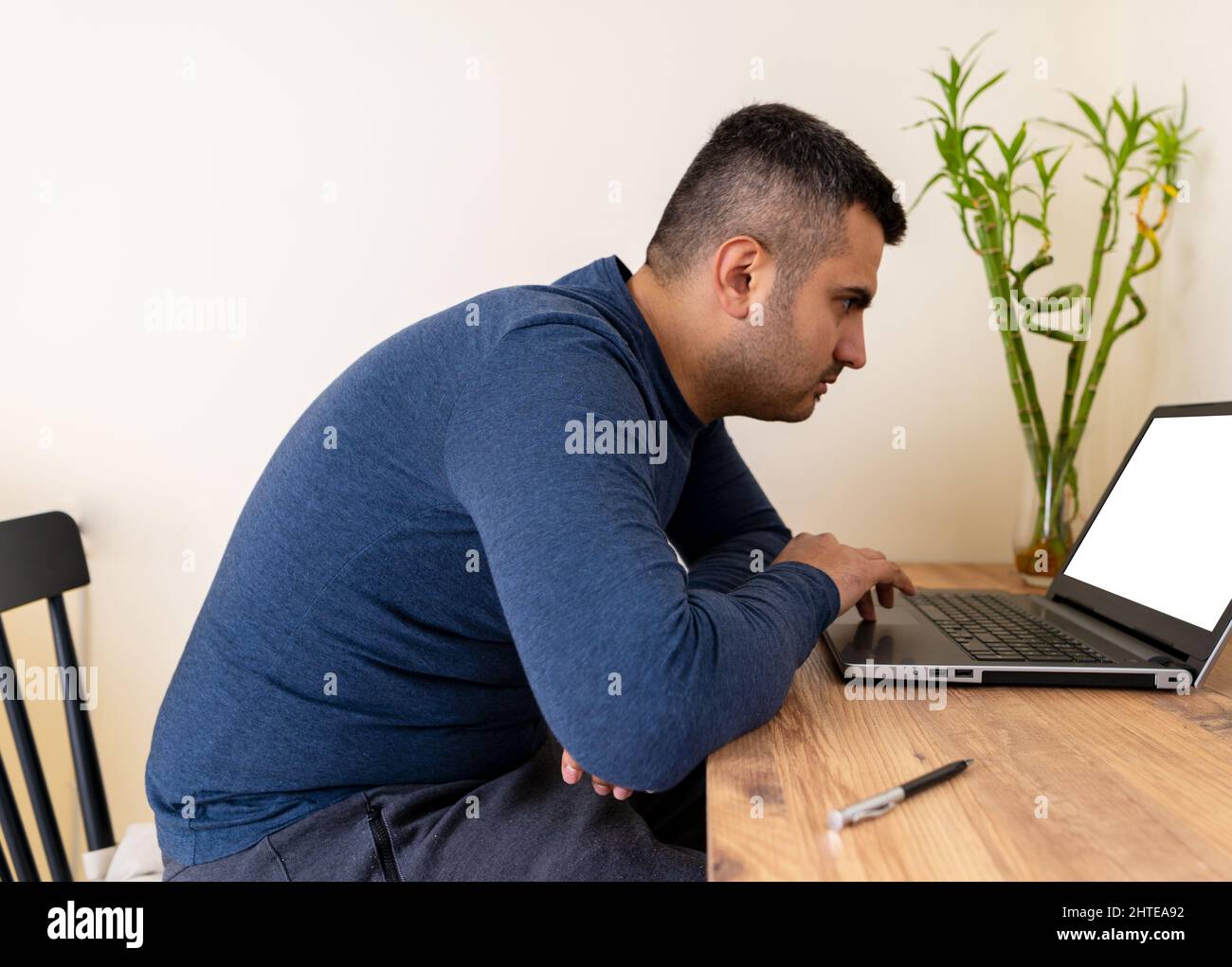 Side view photo of a man with scoliosis, hunched back posture, position defect, curvature or incorrect spine. Stock Photo