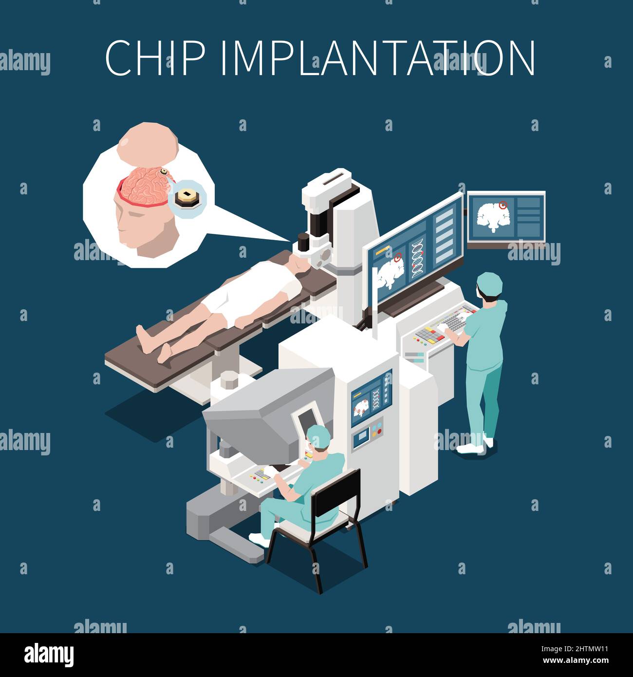 Chip implantation isometric background illustrated high tech surgery operation of implant installation into human brain vector illustration Stock Vector