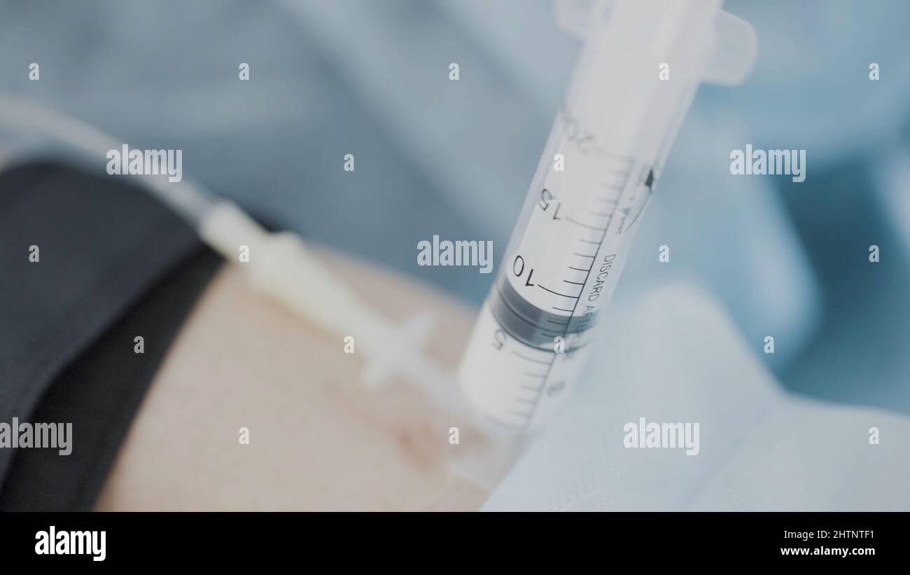 Closeup shot of anesthesia. Action. Injection of anesthesia is injected into patient's arm