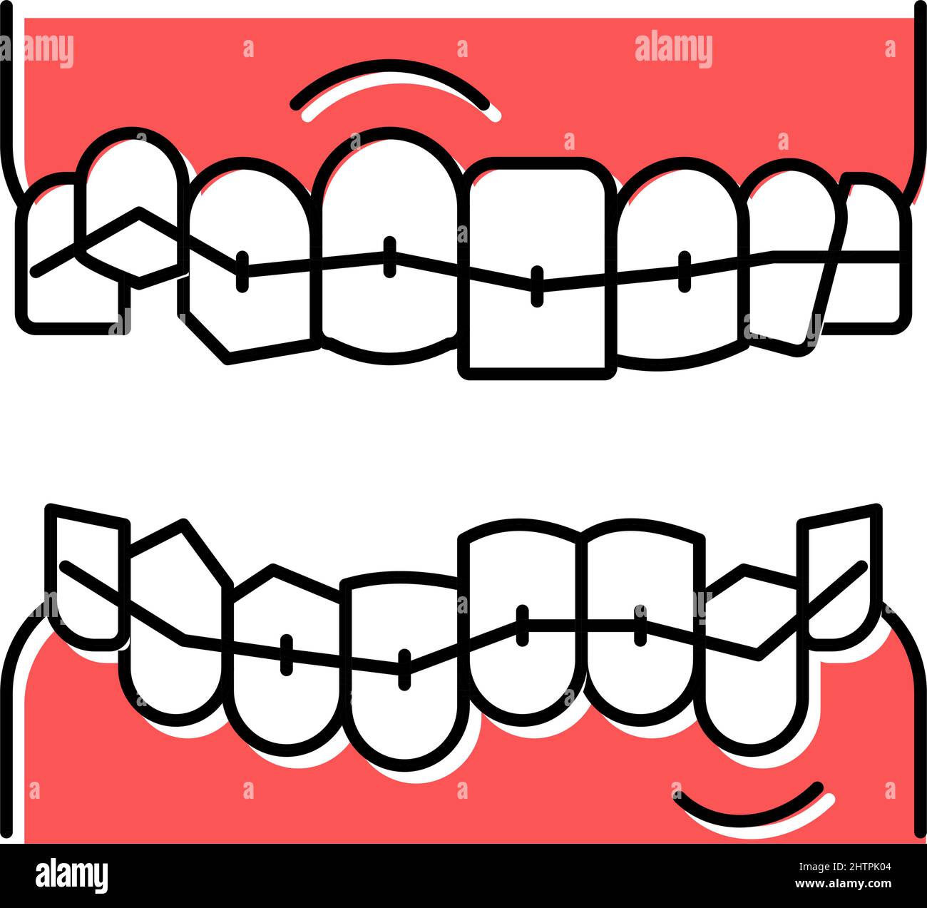 correction tooth braces color icon vector illustration Stock Vector ...