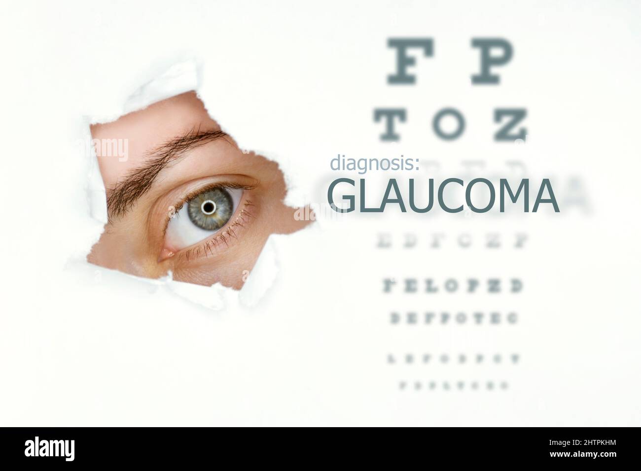 Glaucoma disease poster with eye test and blue eye on left. Isolated on white Stock Photo