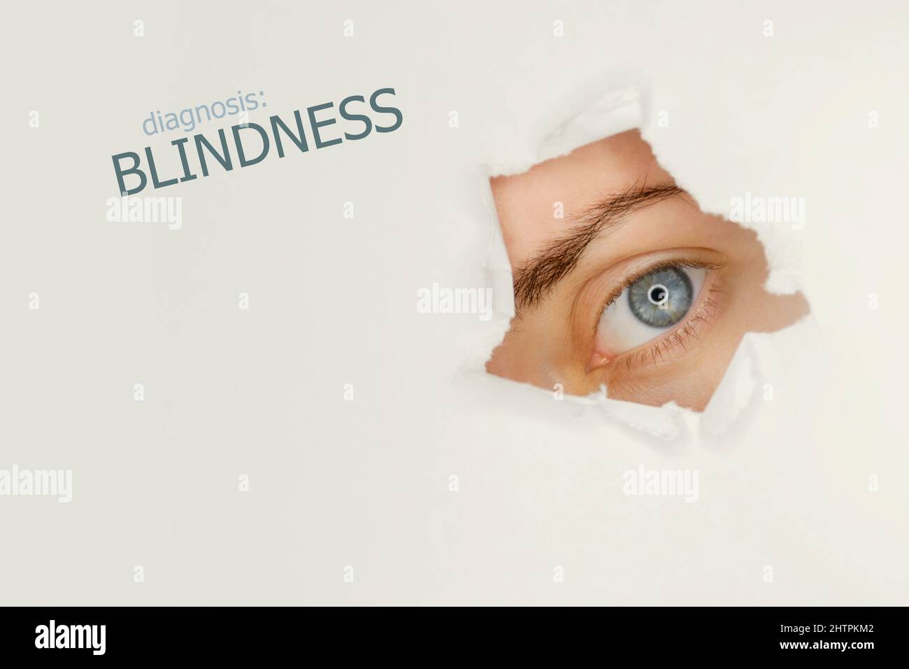 Blindness disease poster with blue eye on right.Studio grey background Stock Photo