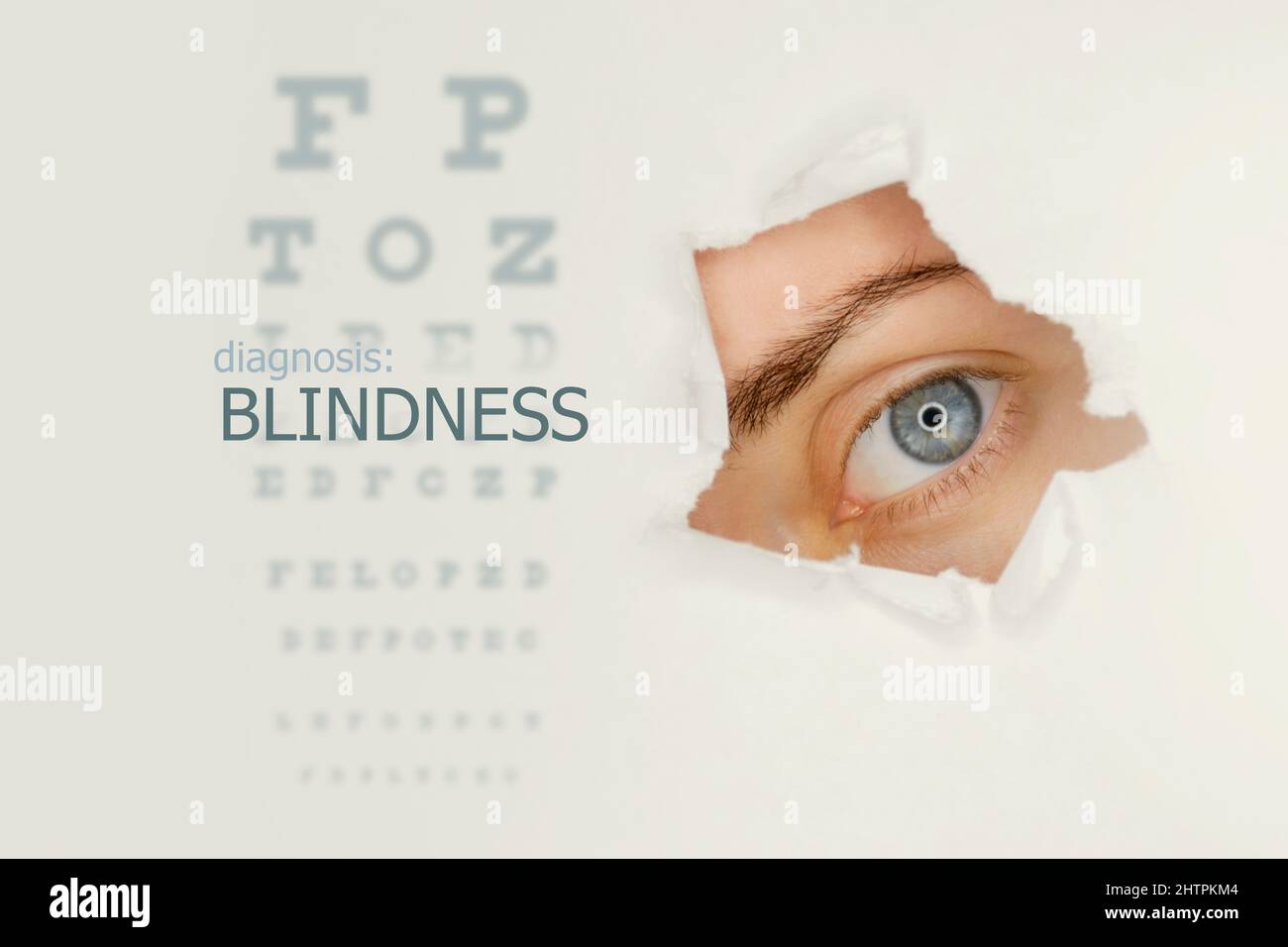 Blindness disease poster with eye test chart and blue eye on right.Studio grey background Stock Photo
