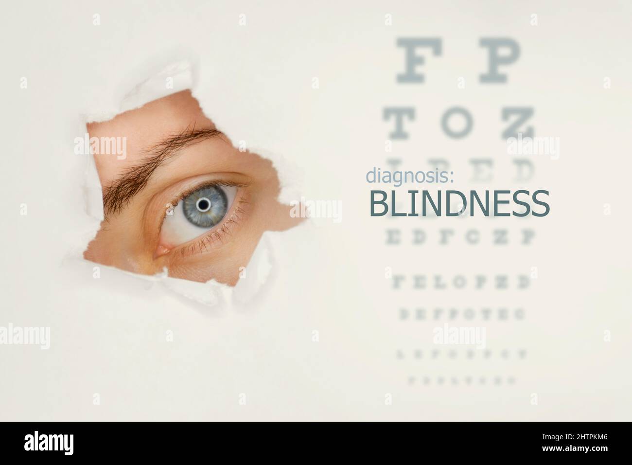 Blindness disease poster with eye test chart and blue eye on left. Studio grey background Stock Photo