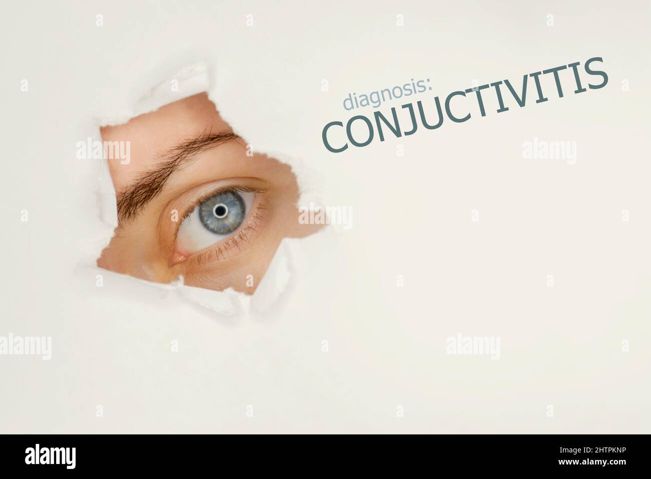Conjuctivitis disease poster with blue eye on left. Studio grey background Stock Photo