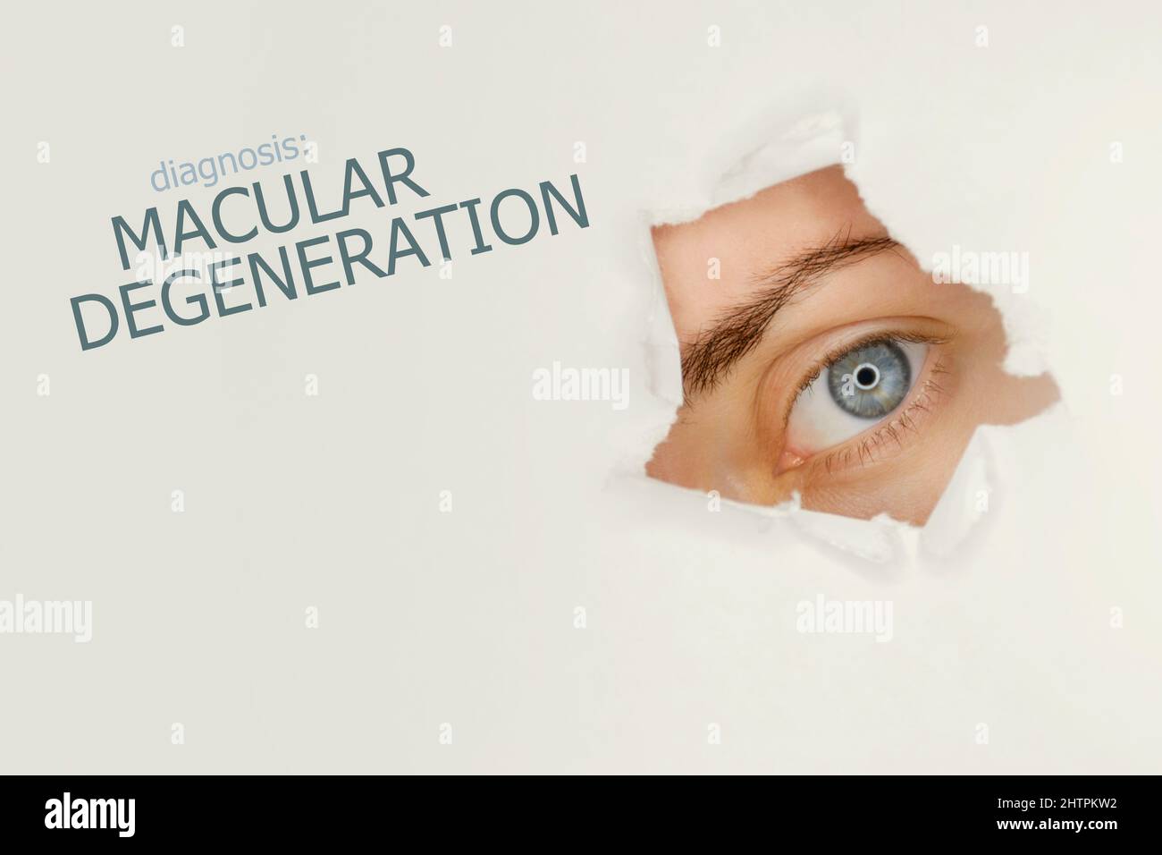 Macular degeneration disease poster with eye test chart and blue eye. Studio grey background Stock Photo