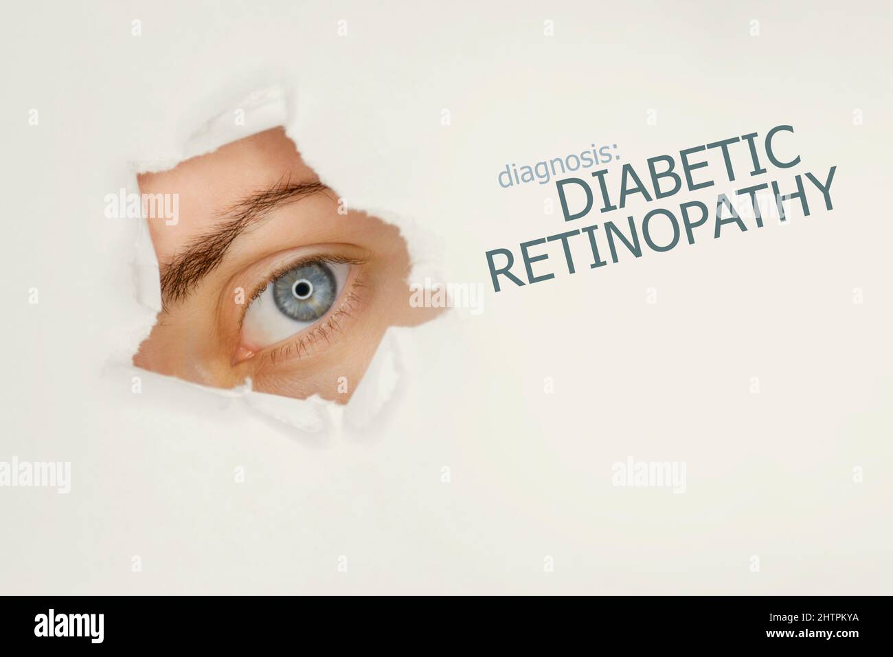Diabetic retinopathy disease poster with eye test chart and blue eye.Studio grey background Stock Photo