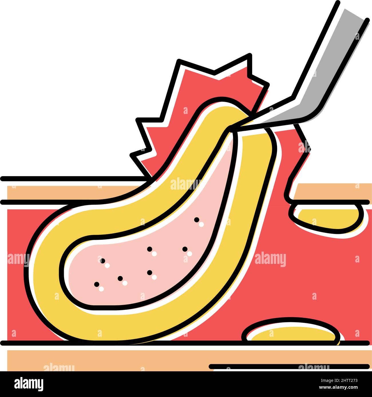 carotid endarterectomy color icon vector illustration Stock Vector ...