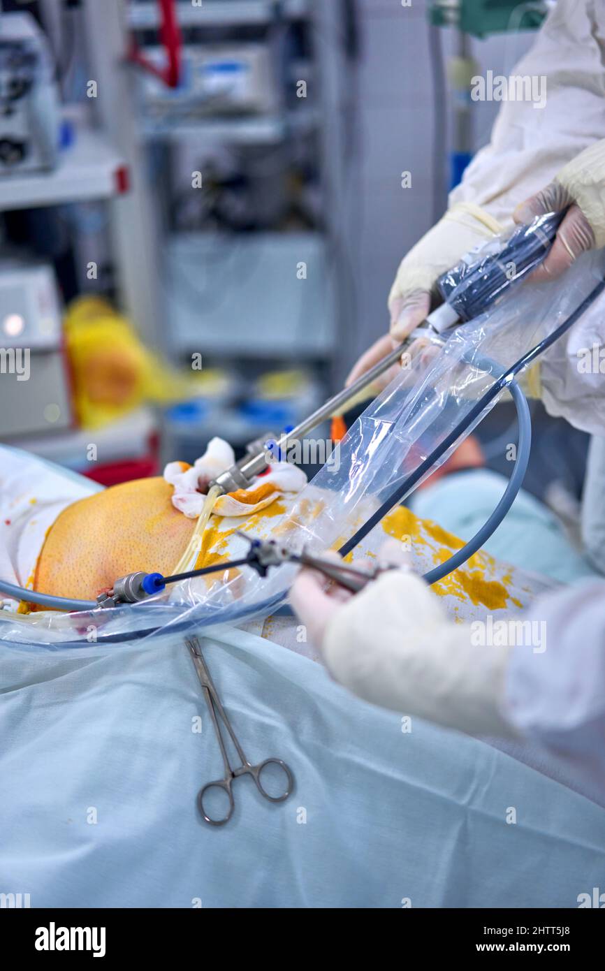 surgeon performs an endoscopic operation Stock Photo Alamy