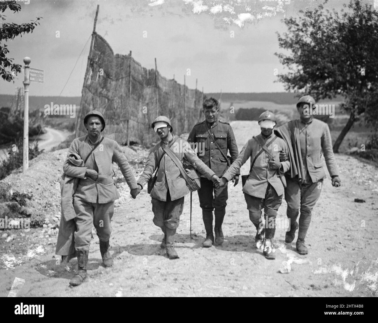A group of four walking wounded French soldiers. Three of the French soldiers are holding hands, guiding the central man who appears to have been injured by gas: his eyes are covered with a bandage. A British soldier can be seen in the centre of the photograph. Stock Photo