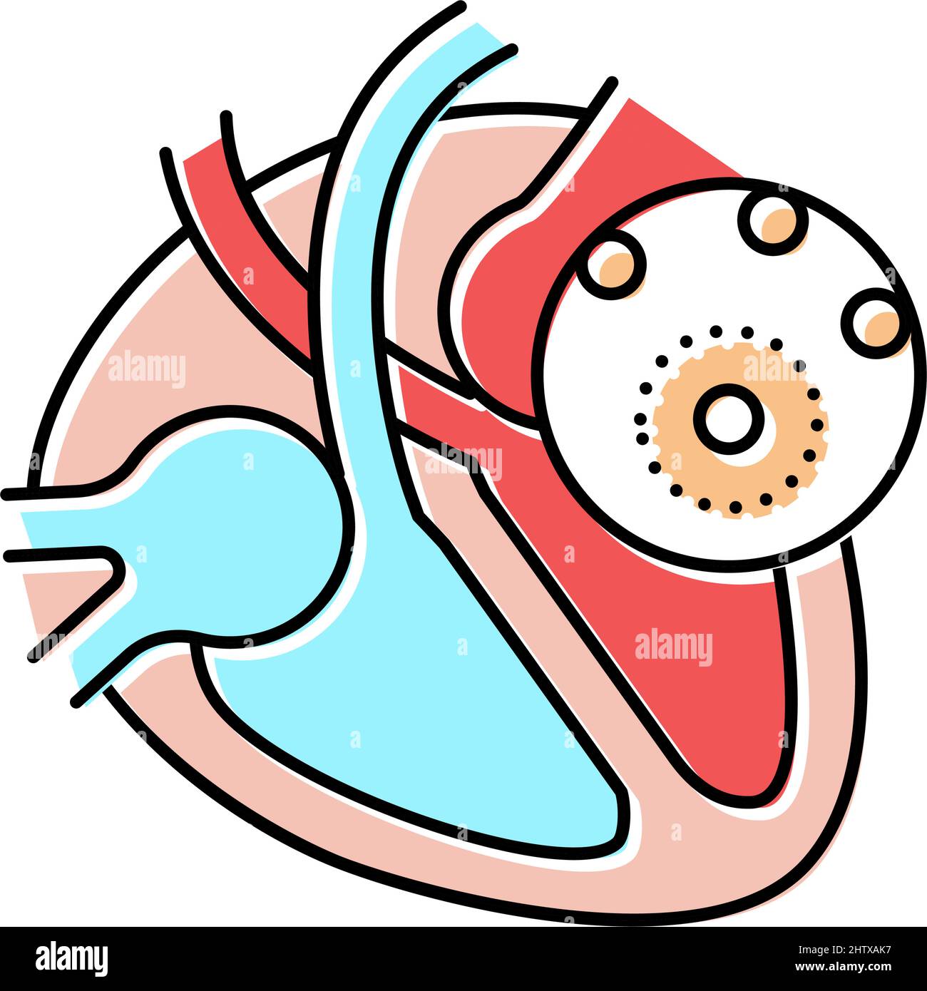 myocarditis disease color icon vector illustration Stock Vector Image ...