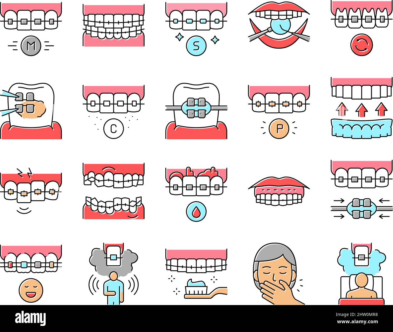 Tooth Braces Accessory Collection Icons Set Vector Stock Vector Image