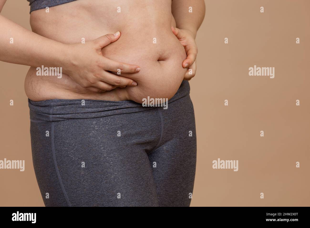 Front view of hands squeezing extra weight big belly of lady in leggings.  Body positive. Violation of cell elasticity, loss of nutrients. Sagging  skin Stock Photo - Alamy