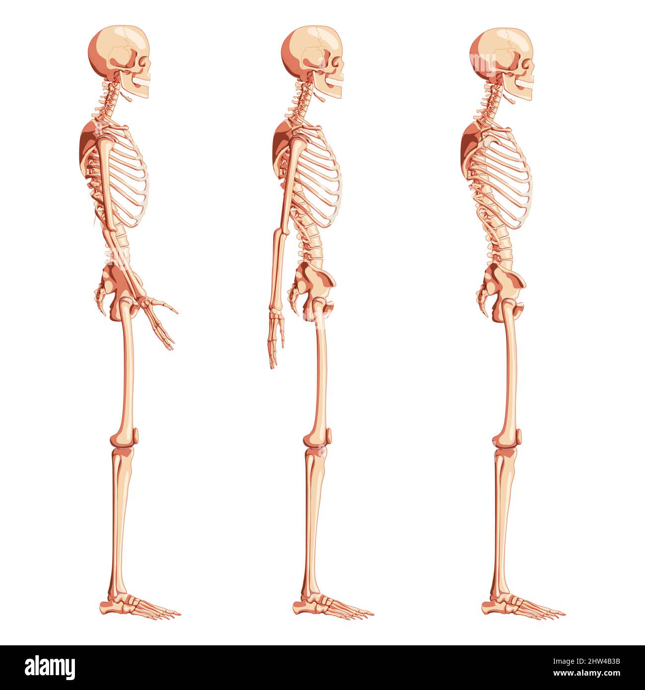 Skeleton Human dorsal side view with armless, open and back arm poses. Set of realistic medical flat natural color concept Vector illustration didactic board of anatomy isolated on white background Stock Vector