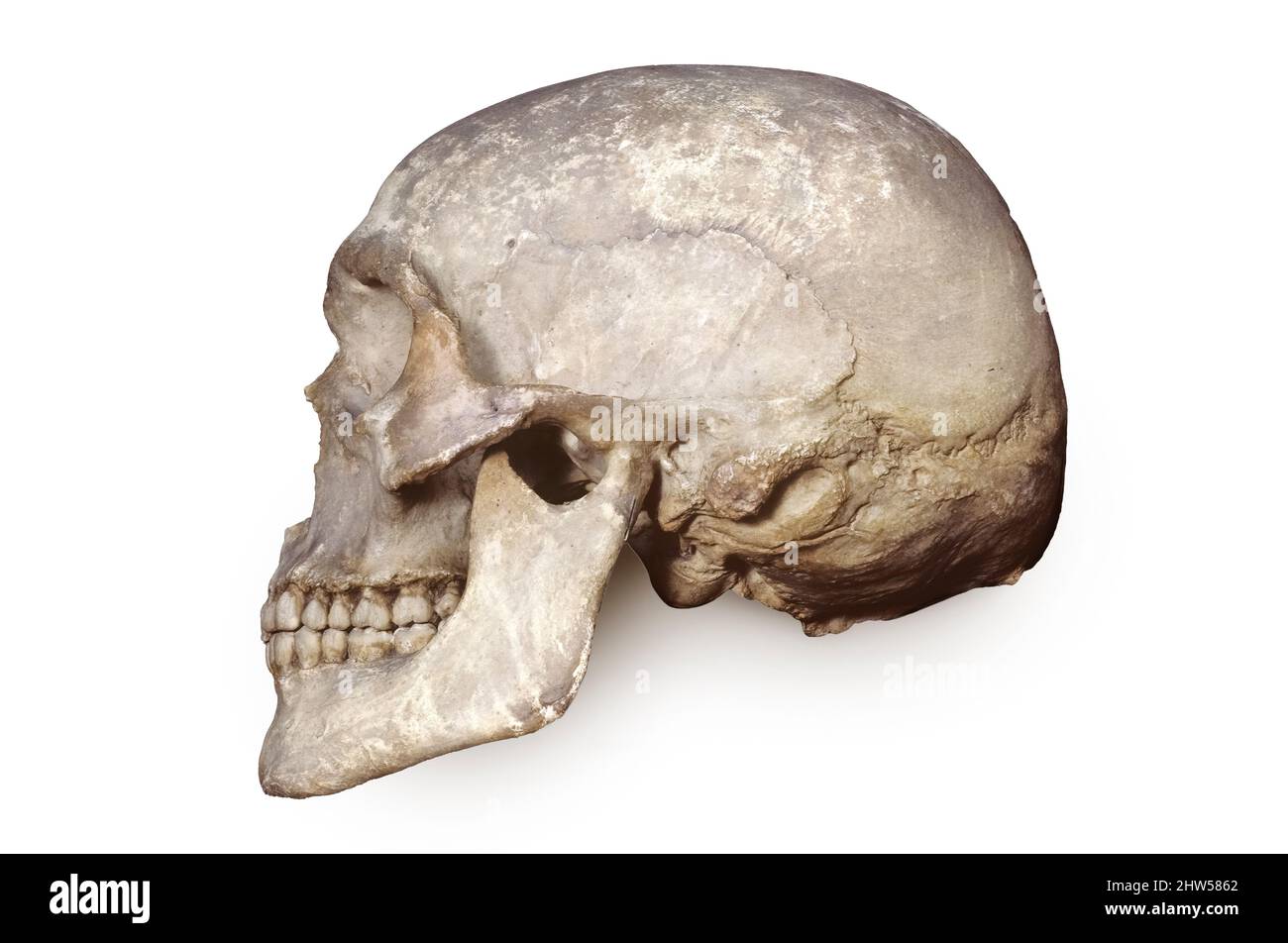 Caucasian Male Skull Stock Photo