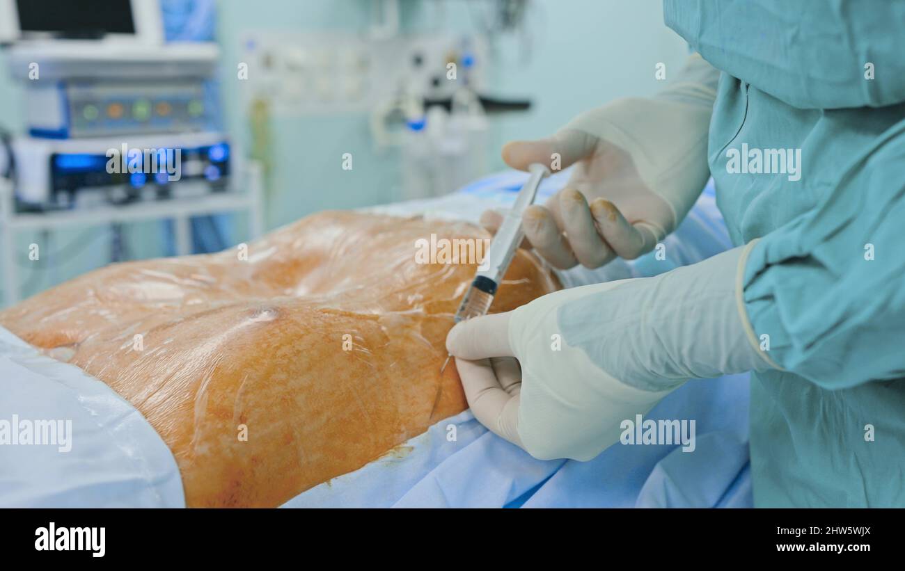 Medical team performing surgical operation in modern operating room ...