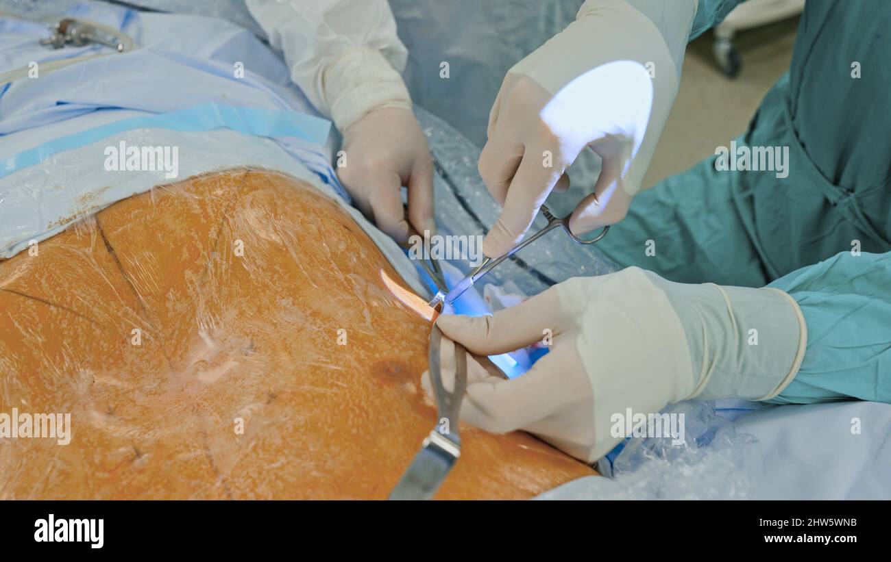 Medical team performing surgical operation in modern operating room ...