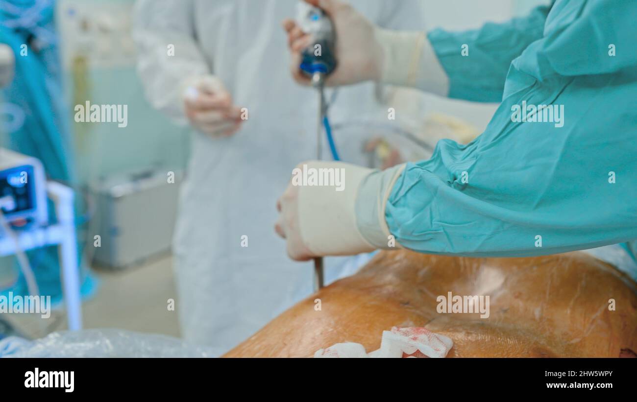 Medical team performing surgical operation in modern operating room ...