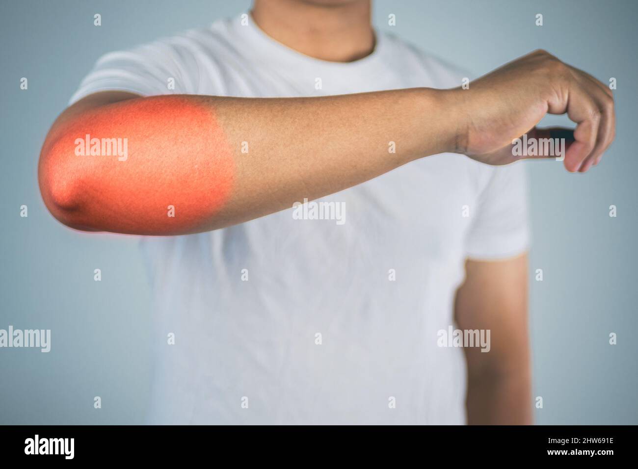 Elbow injury from tennis and golf. Pain symptom area is shown with red