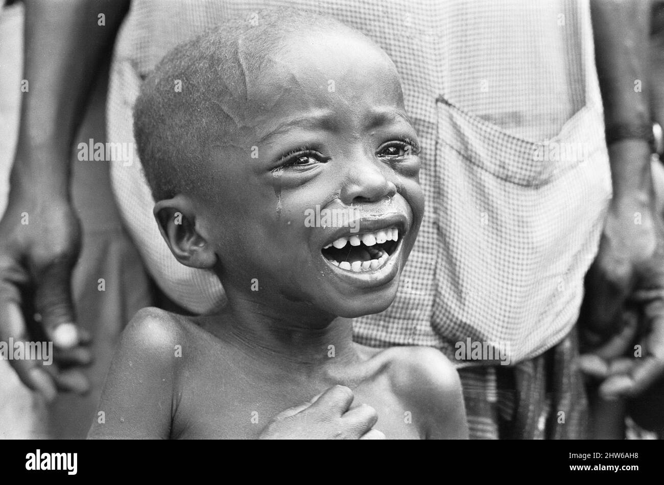 Starving child crying with hunger at the Queen Elizabeth Hospital, Umuahia just a few of the estimated one to two million victims of the Biafran War. 23rd June 1968The Nigerian Civil War, also known as the Biafran War endured for two and a half years, from  6 July 1967 to 15 January 1970, and was fought to counter the secession of Biafra from Nigeria. The indigenous Igbo people of Biafra felt they could no longer co-exist with the Northern-dominated federal government following independence from Great Britain. Political, economic, ethnic, cultural and religious tensions finally boiled over int Stock Photo