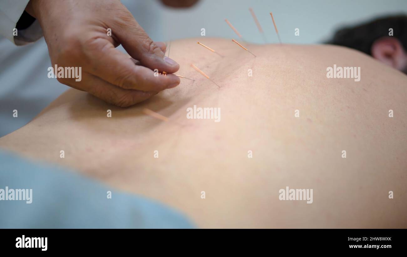 Hand acupuncture therapy points hi-res stock photography and images - Alamy