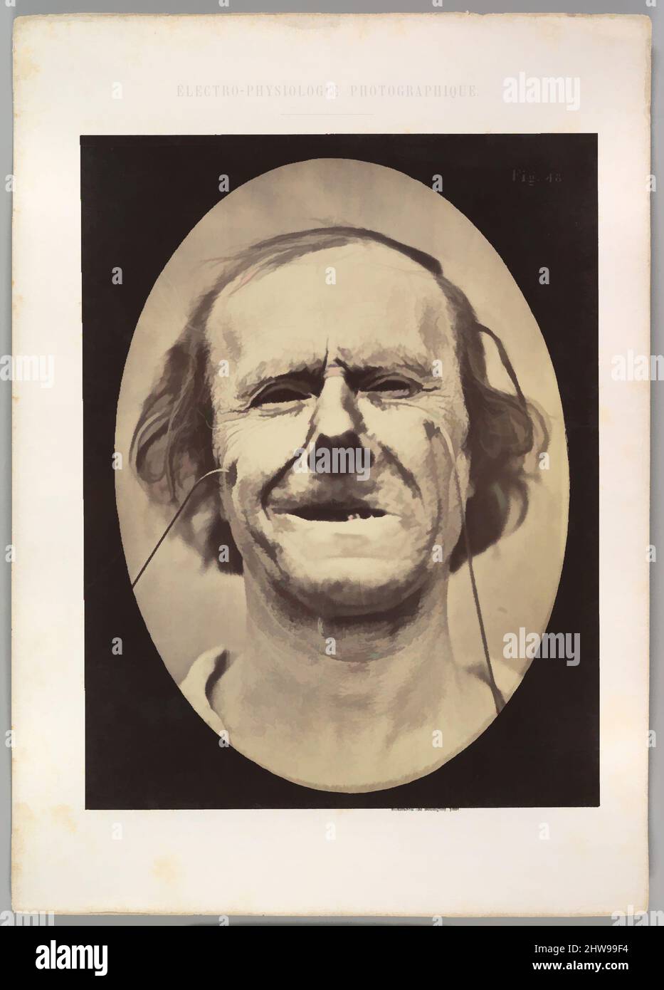 Art inspired by Figure 48: Mild weeping, pity and feeble false laughter, 1854–56, printed 1862, Albumen silver print from glass negative, Image (Oval): 28.5 × 20.4 cm (11 1/4 × 8 1/16 in.), Photographs, Guillaume-Benjamin-Amand Duchenne de Boulogne (French, 1806–1875), Adrien, Classic works modernized by Artotop with a splash of modernity. Shapes, color and value, eye-catching visual impact on art. Emotions through freedom of artworks in a contemporary way. A timeless message pursuing a wildly creative new direction. Artists turning to the digital medium and creating the Artotop NFT Stock Photo