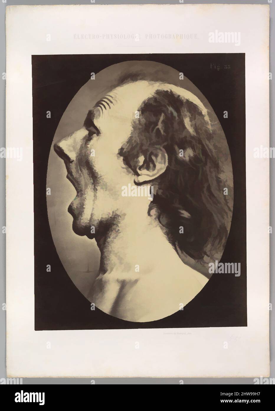 Art inspired by Figure 55: Astonishment badly rendered by the subject: a ridiculous and inane expression., 1854–56, printed 1862, Albumen silver print from glass negative, Image (Oval): 28.3 × 20.4 cm (11 1/8 × 8 1/16 in.), Photographs, Guillaume-Benjamin-Amand Duchenne de Boulogne (, Classic works modernized by Artotop with a splash of modernity. Shapes, color and value, eye-catching visual impact on art. Emotions through freedom of artworks in a contemporary way. A timeless message pursuing a wildly creative new direction. Artists turning to the digital medium and creating the Artotop NFT Stock Photo