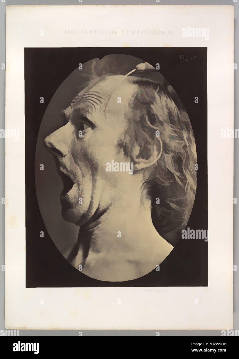 Art inspired by Figure 57: Astonishment, stupefaction, amazement, 1854–56, printed 1862, Albumen silver print from glass negative, Image (Oval): 28.3 × 20.3 cm (11 1/8 × 8 in.), Photographs, Guillaume-Benjamin-Amand Duchenne de Boulogne (French, 1806–1875), Adrien Tournachon (French, Classic works modernized by Artotop with a splash of modernity. Shapes, color and value, eye-catching visual impact on art. Emotions through freedom of artworks in a contemporary way. A timeless message pursuing a wildly creative new direction. Artists turning to the digital medium and creating the Artotop NFT Stock Photo