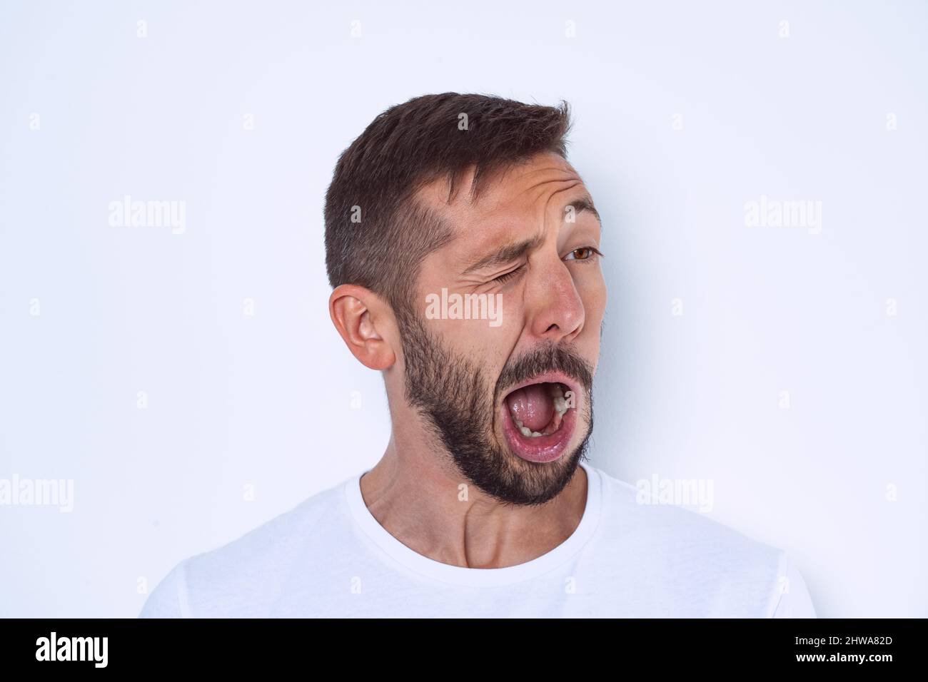 Young man suffering from Tourette syndrome or TS. Face nerve disorders Stock Photo