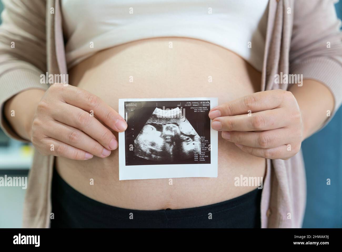 A cute pregnant belly and x-ray ultrasound scan of baby. Pregnant