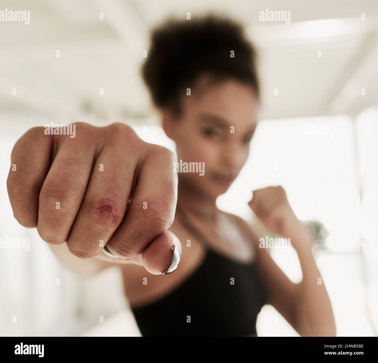 Scars and stories hires stock photography and images Alamy