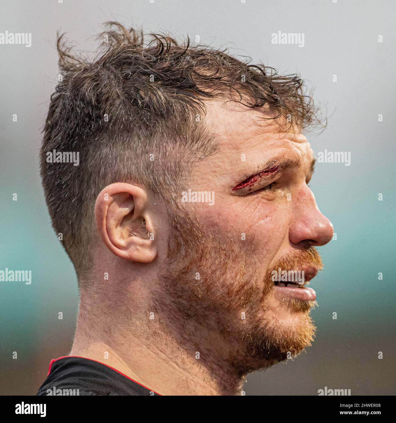 Barnet, United Kingdom. 05th Mar, 2022. Gallagher Premiership Rugby. Saracens V Leicester Tigers. StoneX Stadium. Barnet. a battered Tim Swinson of Saracens Credit: Sport In Pictures/Alamy Live News Stock Photo
