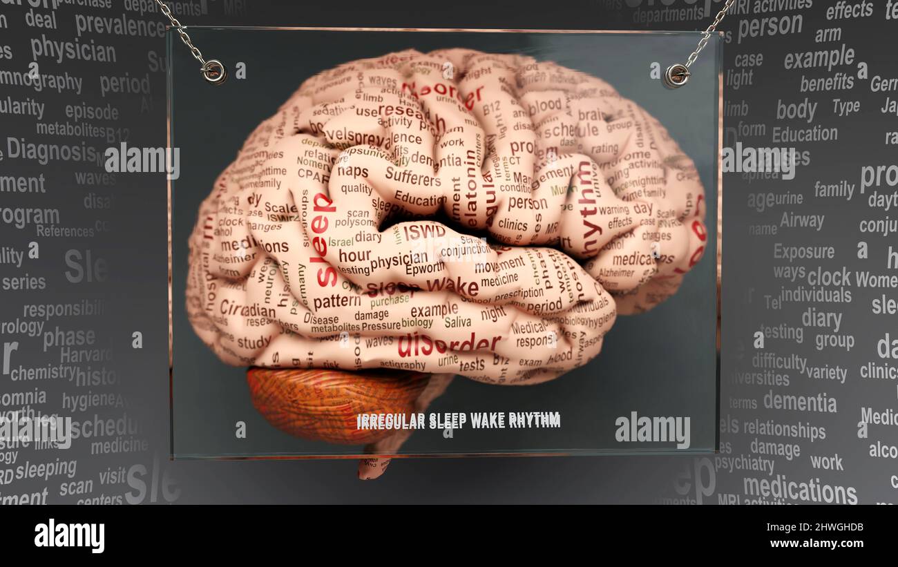 Irregular sleep wake rhythm anatomy - its causes and effects projected ...