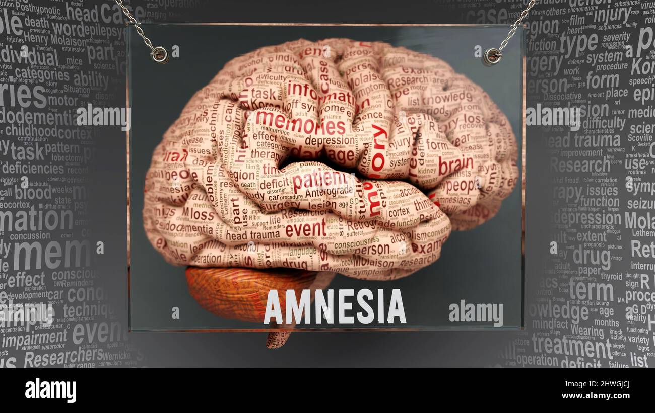 Amnesia anatomy - its causes and effects projected on a human brain revealing Amnesia complexity and relation to human mind. Concept art, 3d illustrat Stock Photo