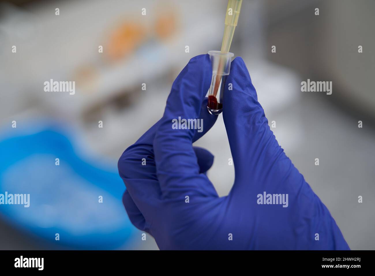 Nurse working with medical instrument in the hospital Stock Photo - Alamy