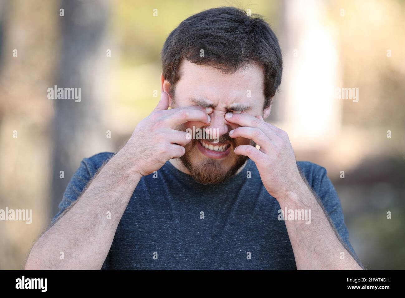 Front view portrait of a man scretching itchy eyes in nature Stock Photo