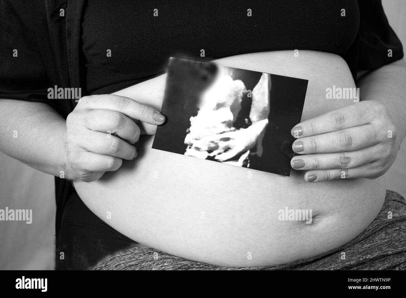 Baby Scan Black And White Stock Photos Images Alamy