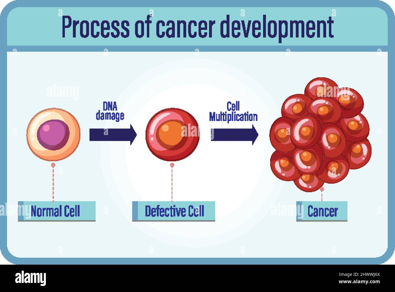 Process of cancer development illustration Stock Vector Image & Art - Alamy