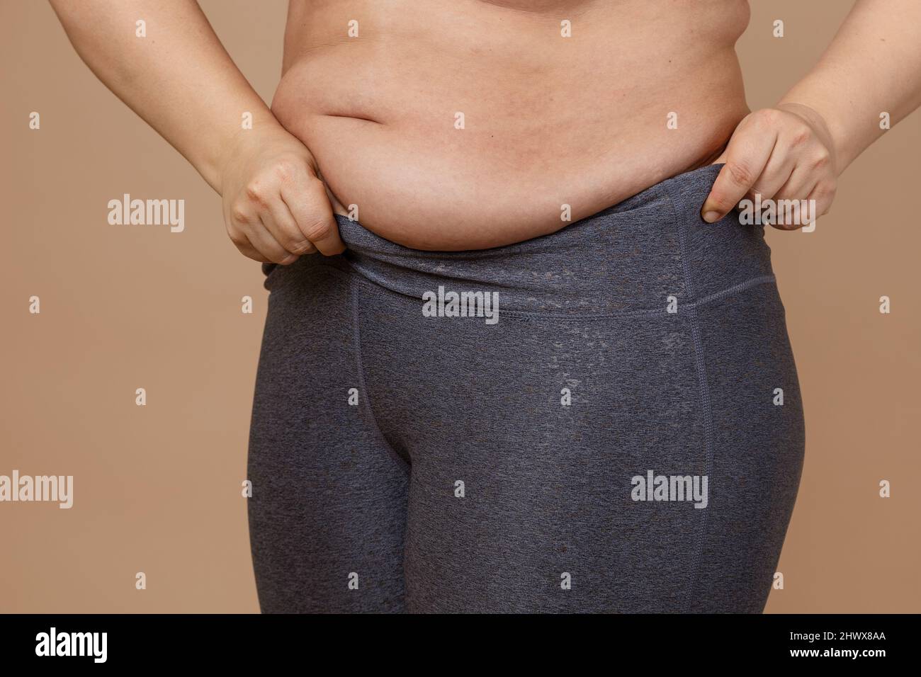 legs and belly of a 40-year-old woman with stretch marks, cellulite and  excess weight on a white isolated background Stock Photo - Alamy