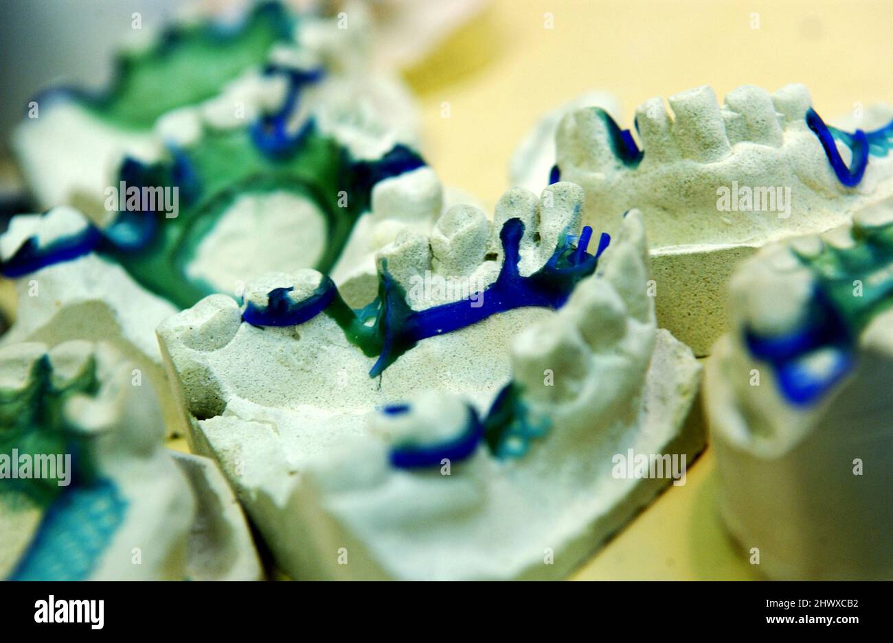 A set of dental casts at dental laboratory Stock Photo Alamy