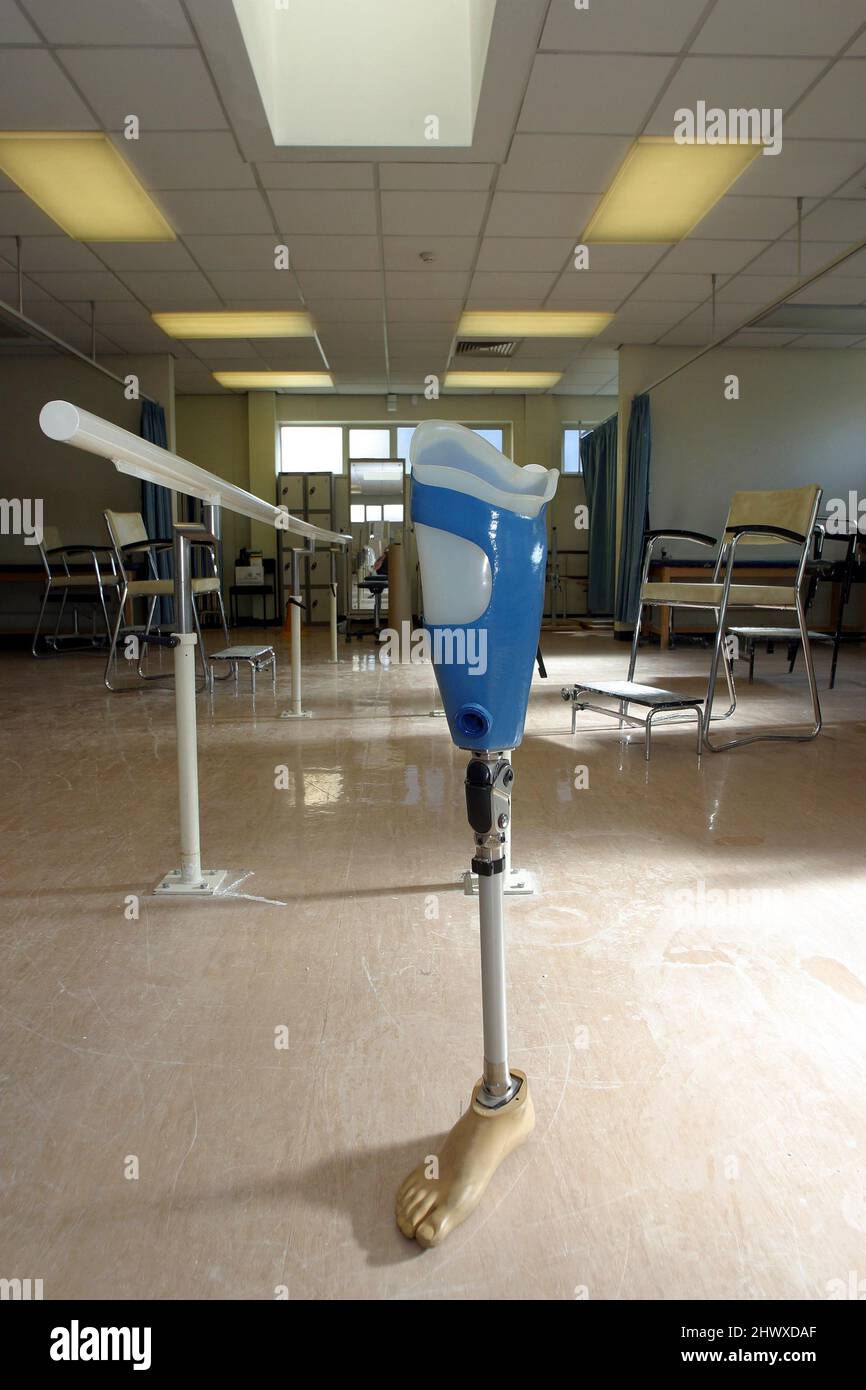 An above the knee prosthesis with exercise hand rails in the background Stock Photo
