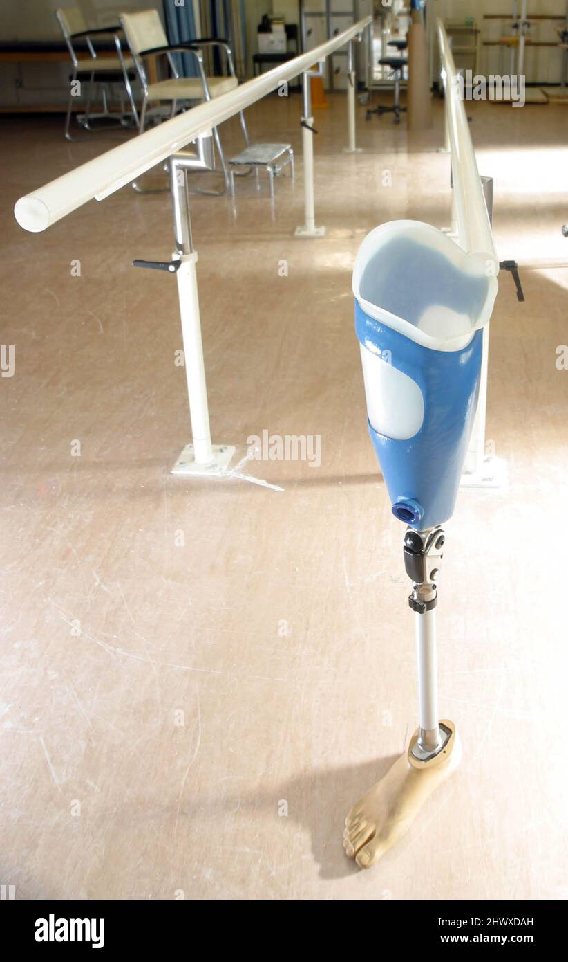 An above the knee prosthesis with exercise hand rails in the background Stock Photo
