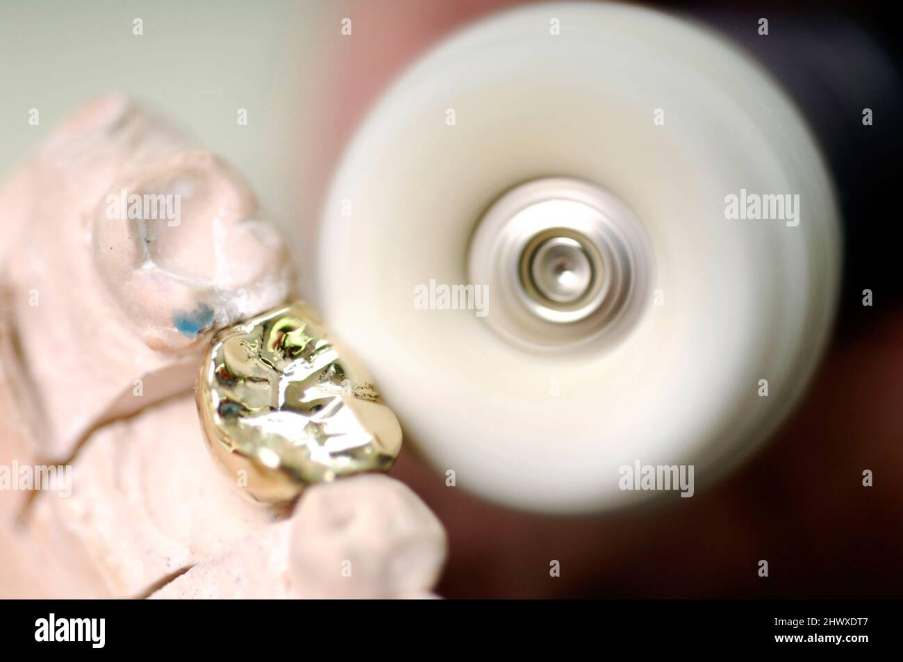 Gold teeth denture hires stock photography and images Alamy