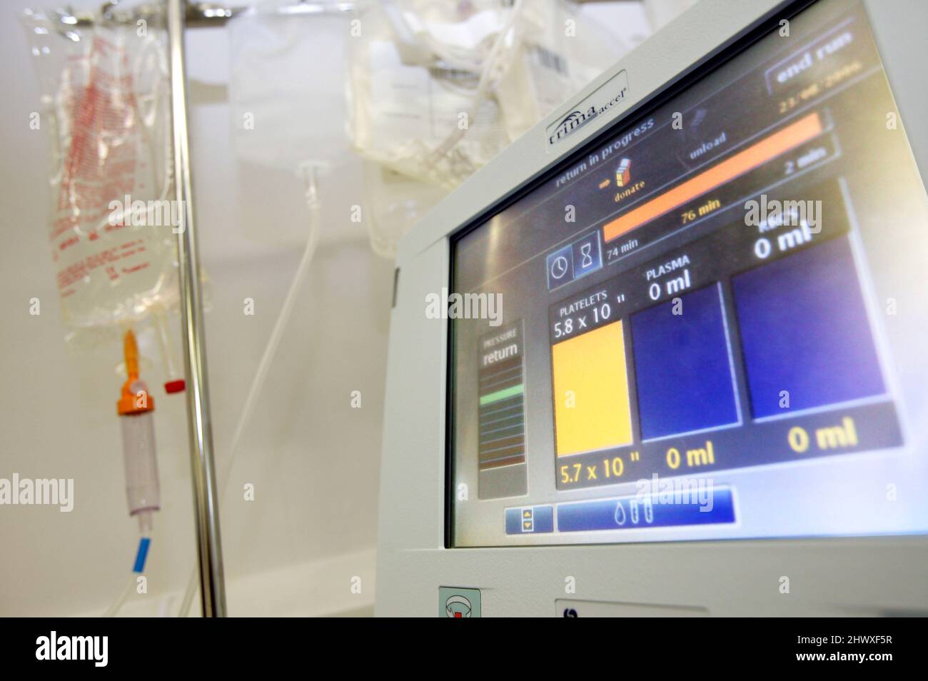 The user interface of the Trima Accel, an online automated blood