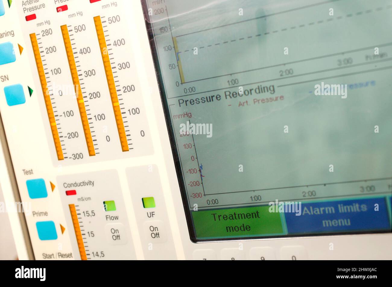 Close up of a dialysis machine. The kidney dialysis machine acts as an