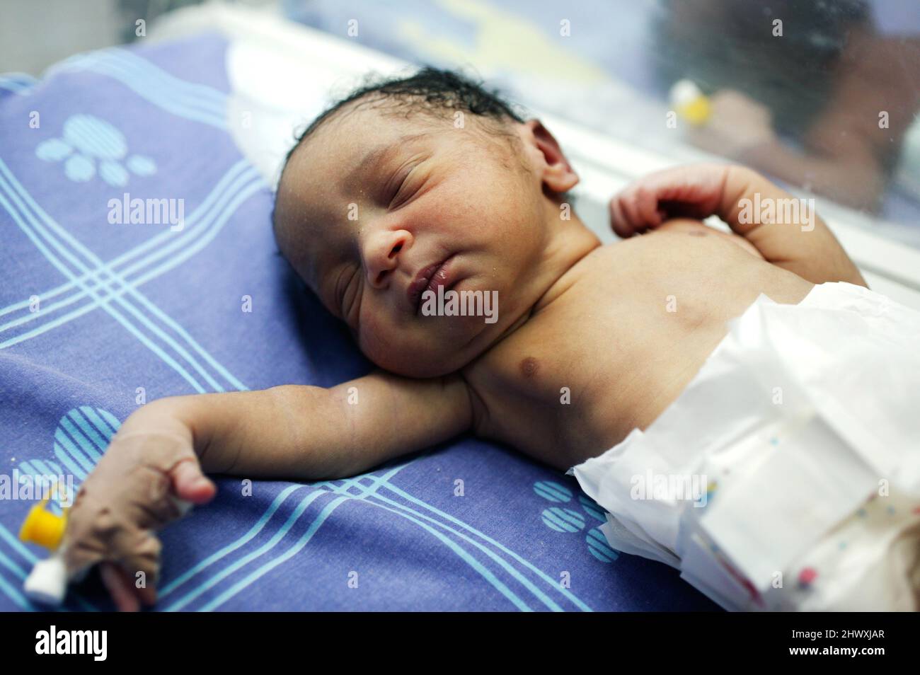 Close-up of a premature baby boy. Stock Photo